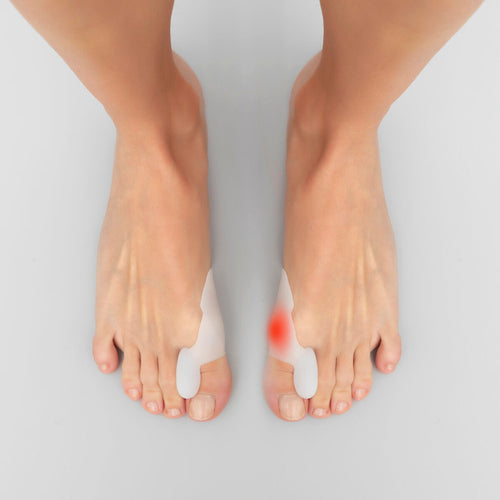 Ballenzeh-Korrektor aus Silikon - 2 Einheiten | Schmerzlinderung und Schutz